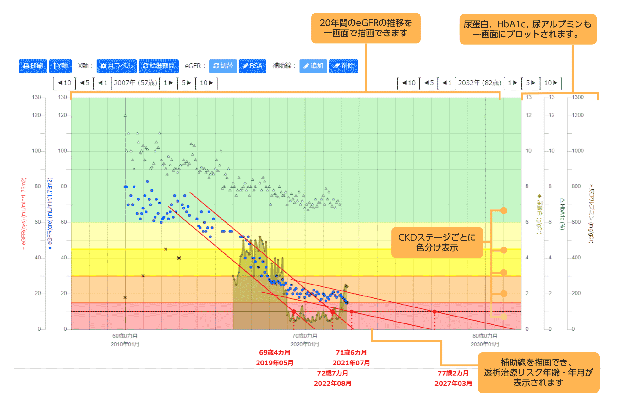 Long term eGFR plot　画面イメージ